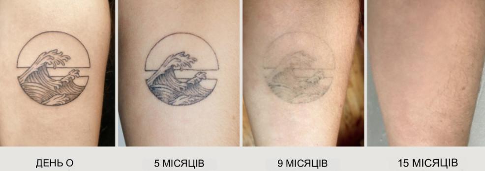 tymchas-ephemer-tatu-bizmag-com-ua