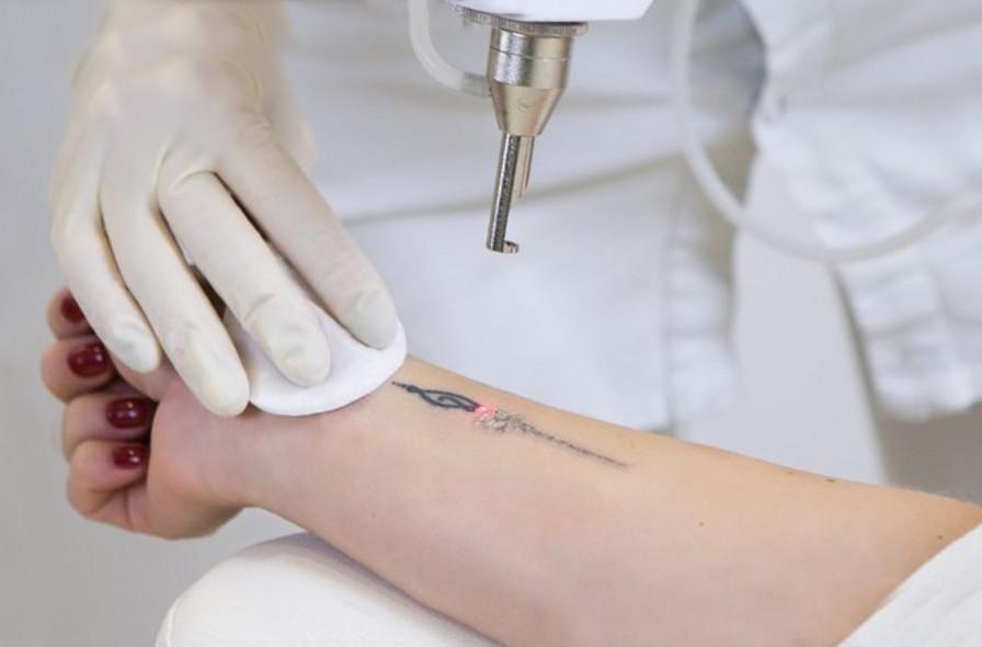 vydalennya-tatu-bizmag-com-ua